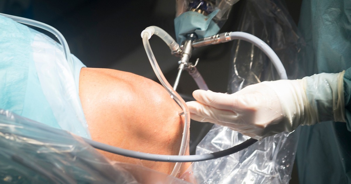 What Are the Benefits of Knee Arthroscopy in Essex?